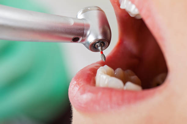 Best Emergency Dental Care for Sports Injuries in Fairfax, MN